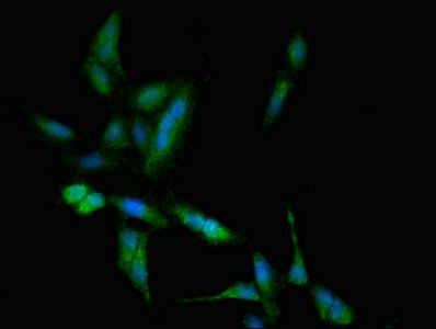 TBC1D4 Antibody