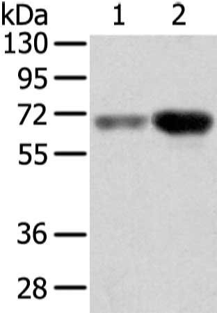 TBL1X Antibody