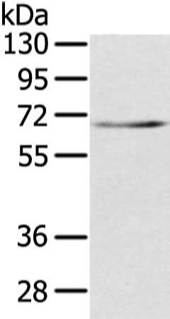 TBL1X Antibody
