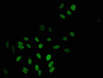 TBL1X Antibody