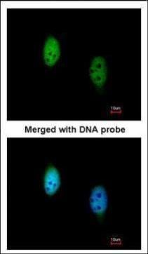 TBLR1 antibody [N3C3]