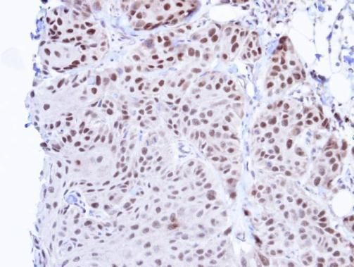 TBLR1 antibody [N3C3]