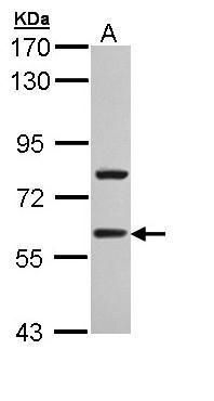 TBLR1 antibody [N3C3]