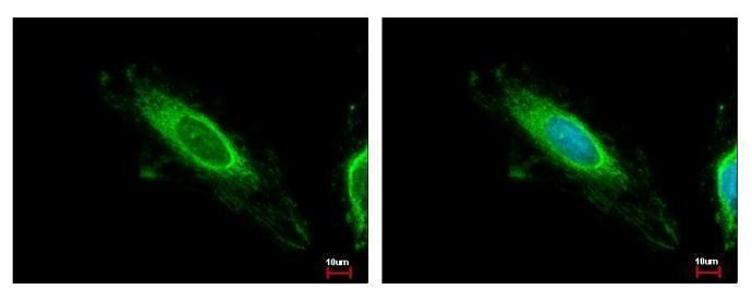 TBRG4 antibody