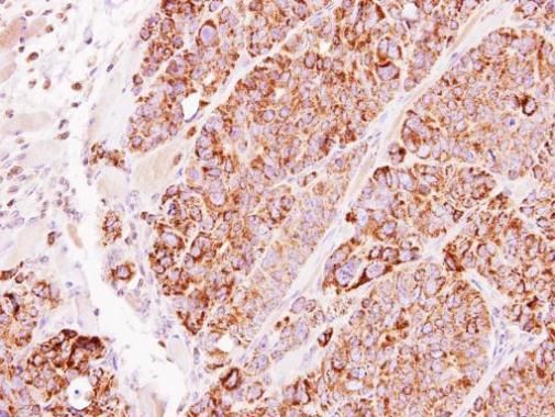 TBRG4 antibody