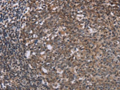 TBX5 Antibody
