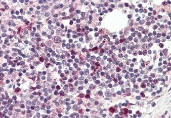 Tcfec (mouse) Antibody