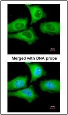 TCP1 epsilon antibody [N1C1]