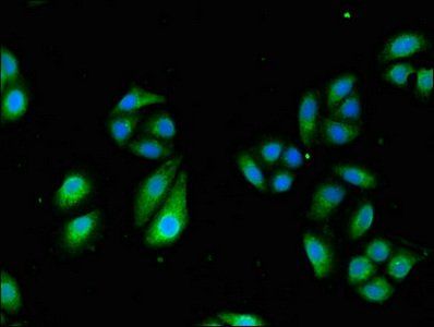 TCTN3 Antibody