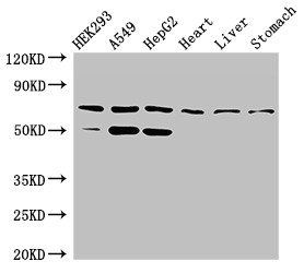 TCTN3 Antibody
