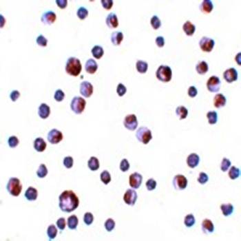 TCTN3 Antibody