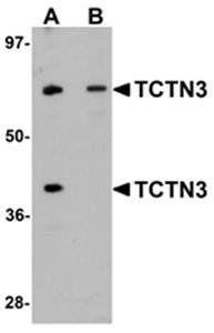TCTN3 Antibody
