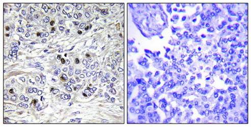 TEAD2 Antibody
