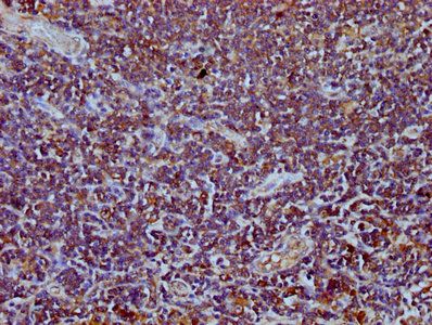 TEFM Antibody