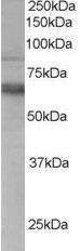 TEM8/Anthrax Toxin Receptor 1 Antibody