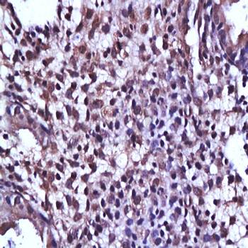 Thioester-containing protein 1 Rabbit Polyclonal Antibody