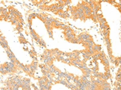 TERF1 Antibody