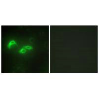 TFAM Antibody
