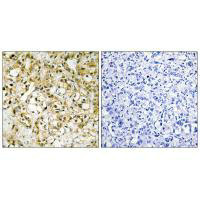 TFAM Antibody
