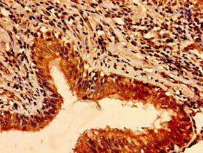 TFAP2C Antibody
