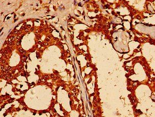 TFAP2C Antibody