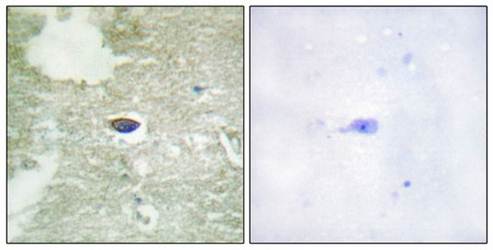 TGF β Receptor II (Phospho-Ser225/250) Antibody