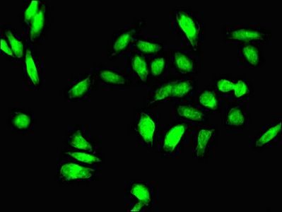 TGIF1 Antibody