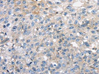 THAP2 Antibody