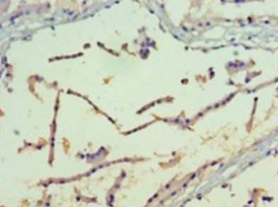 PAK4 Antibody