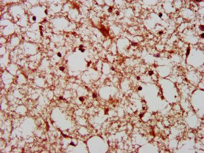 PAK4 Antibody