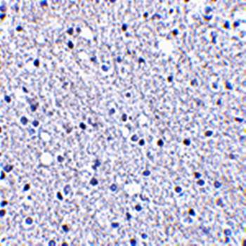 TIGAR Antibody