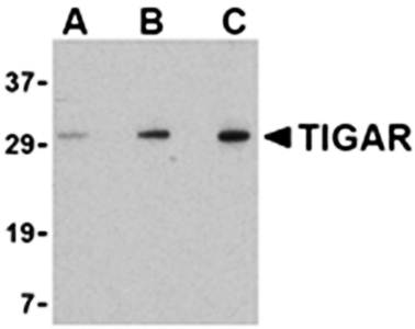 TIGAR Antibody