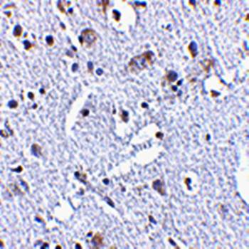 TIGAR Antibody