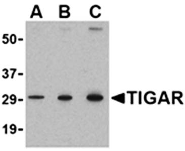 TIGAR Antibody