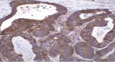 Mouse anti Human Tissue Inhibitor of Matrix Metalloproteinase 2 (TIMP2)