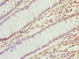 F3 Antibody