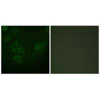 TK1 (Ab-13) Antibody