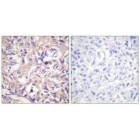 TK1 (Ab-13) Antibody