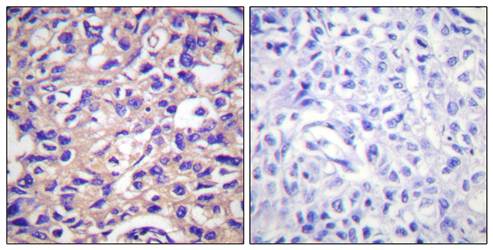 TK (Phospho-Ser13) Antibody