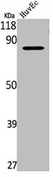 TLK1 Antibody