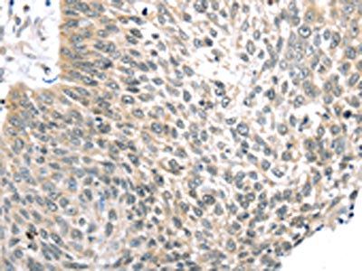 TLK2 Antibody