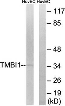 TMBIM1 Antibody