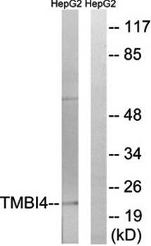 TMBIM4 Antibody