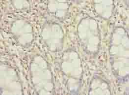 TMEM154 Antibody