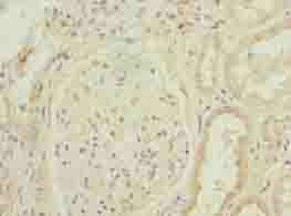 TMEM154 Antibody