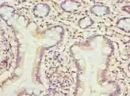 TMEM154 Antibody