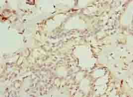 TMEM154 Antibody