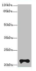 TMEM154 Antibody