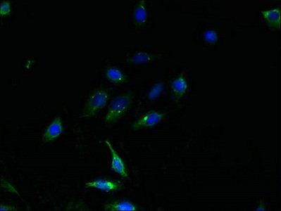 TMEM159 Antibody