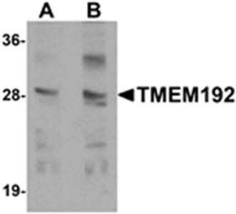 TMEM192 Antibody